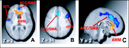 �X���[�W���M���O�Ɣ]�g�F�X���[�W���M���O���L�Q�F���̈�����.com